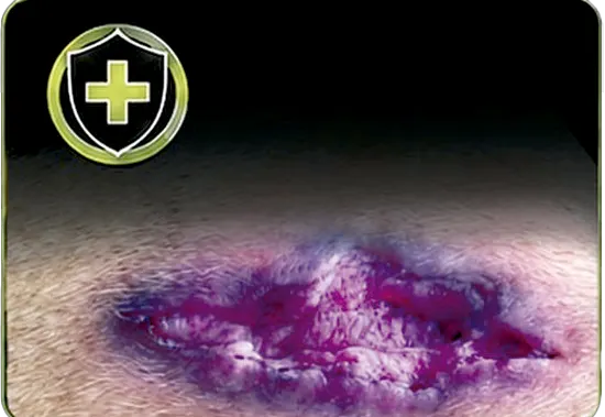 Efecto cicatrizante protector de heridas